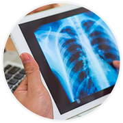 patient-with-problems-on-lungs-xray-shows
